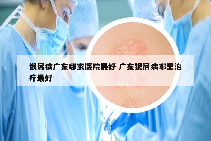 银屑病广东哪家医院最好 广东银屑病哪里治疗最好