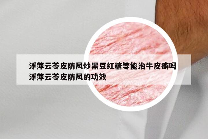 浮萍云苓皮防风炒黑豆红糖等能治牛皮癣吗 浮萍云苓皮防风的功效