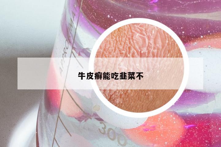 牛皮癣能吃韭菜不