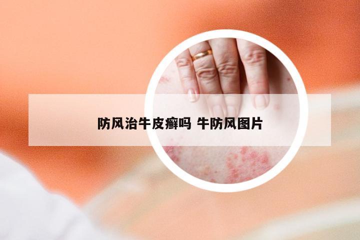 防风治牛皮癣吗 牛防风图片
