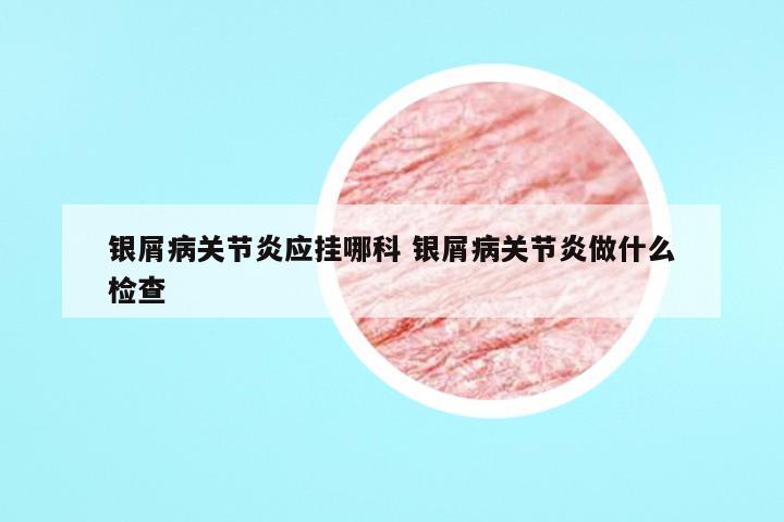 银屑病关节炎应挂哪科 银屑病关节炎做什么检查