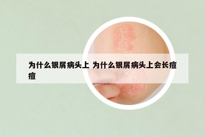 为什么银屑病头上 为什么银屑病头上会长痘痘