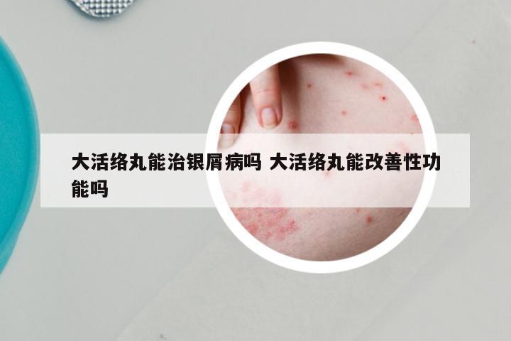 大活络丸能治银屑病吗 大活络丸能改善性功能吗