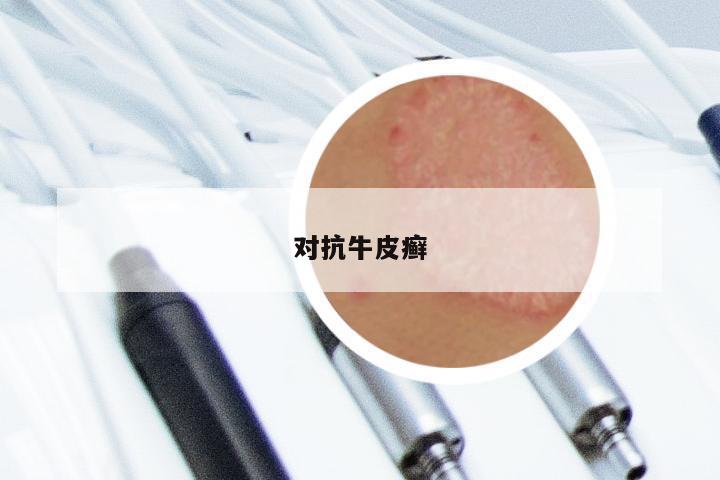 对抗牛皮癣