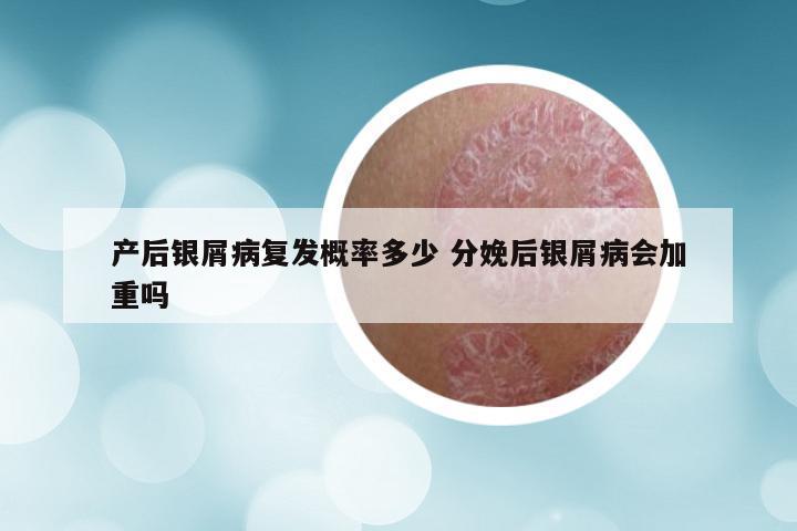 产后银屑病复发概率多少 分娩后银屑病会加重吗