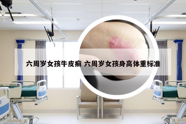 六周岁女孩牛皮癣 六周岁女孩身高体重标准