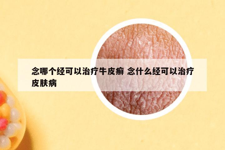 念哪个经可以治疗牛皮癣 念什么经可以治疗皮肤病