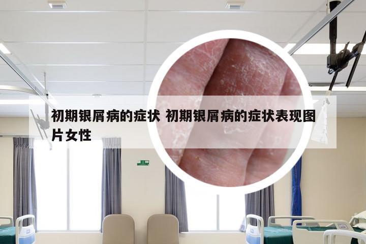初期银屑病的症状 初期银屑病的症状表现图片女性