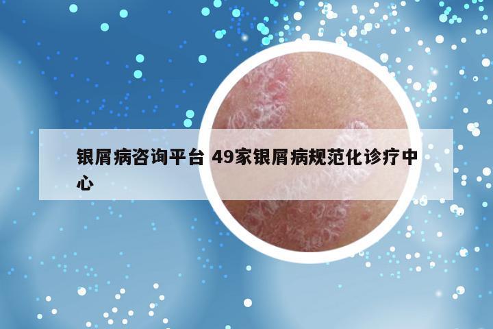银屑病咨询平台 49家银屑病规范化诊疗中心