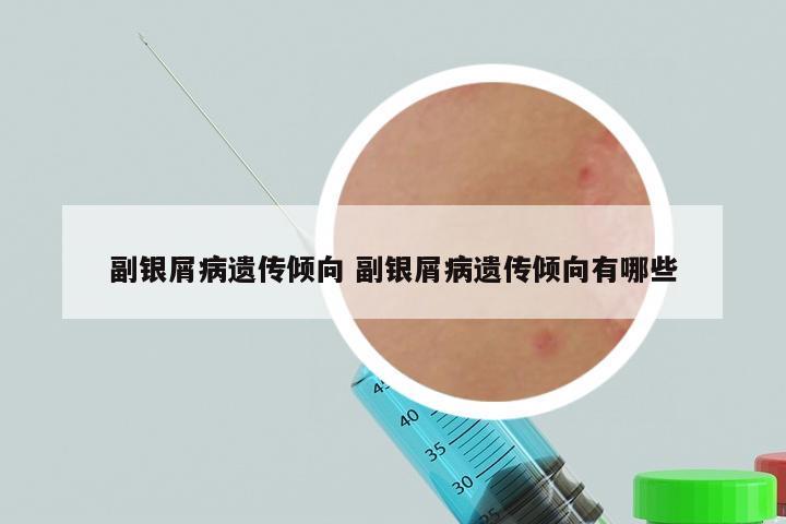 副银屑病遗传倾向 副银屑病遗传倾向有哪些