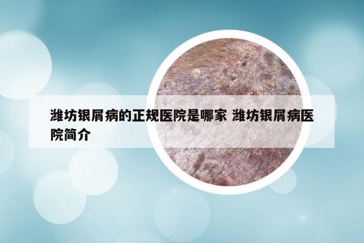 潍坊银屑病的正规医院是哪家 潍坊银屑病医院简介