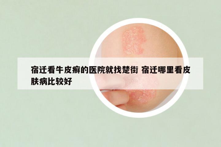 宿迁看牛皮癣的医院就找楚街 宿迁哪里看皮肤病比较好