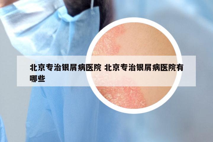 北京专治银屑病医院 北京专治银屑病医院有哪些
