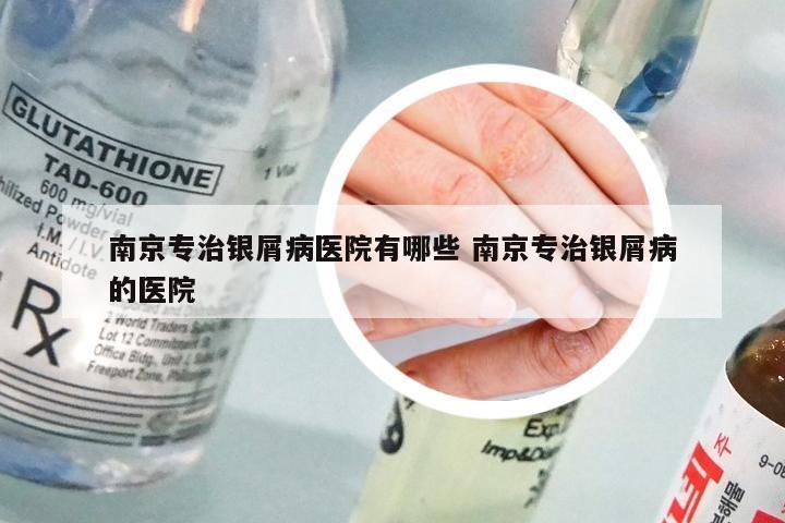 南京专治银屑病医院有哪些 南京专治银屑病的医院