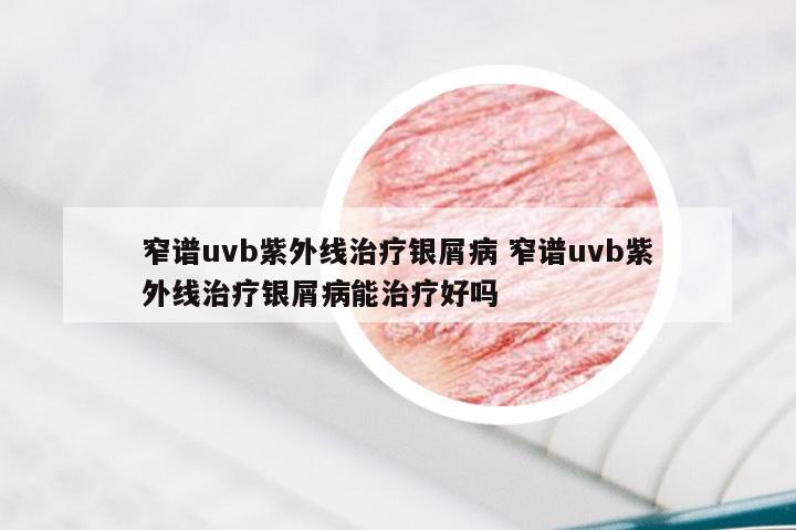 窄谱uvb紫外线治疗银屑病 窄谱uvb紫外线治疗银屑病能治疗好吗