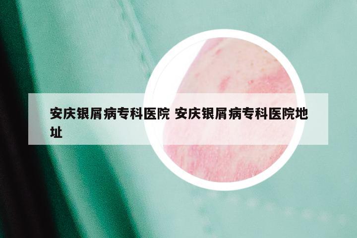安庆银屑病专科医院 安庆银屑病专科医院地址