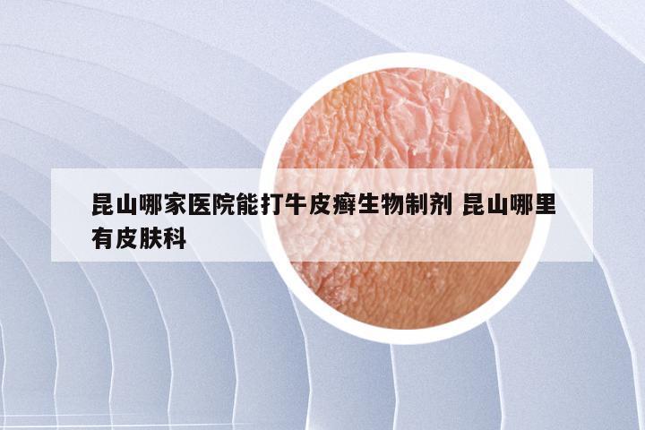 昆山哪家医院能打牛皮癣生物制剂 昆山哪里有皮肤科
