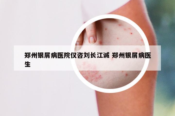 郑州银屑病医院仅咨刘长江诚 郑州银屑病医生