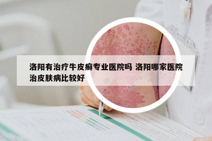 洛阳有治疗牛皮癣专业医院吗 洛阳哪家医院治皮肤病比较好