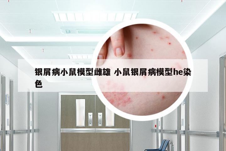银屑病小鼠模型雌雄 小鼠银屑病模型he染色