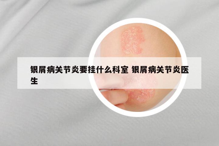 银屑病关节炎要挂什么科室 银屑病关节炎医生