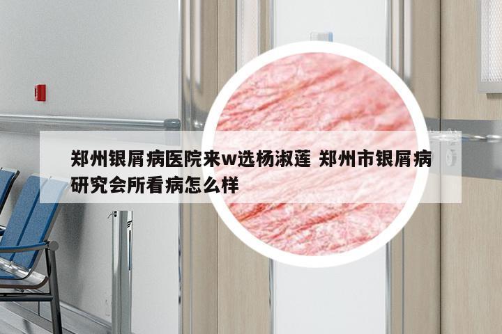 郑州银屑病医院来w选杨淑莲 郑州市银屑病研究会所看病怎么样