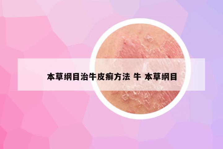 本草纲目治牛皮癣方法 牛 本草纲目
