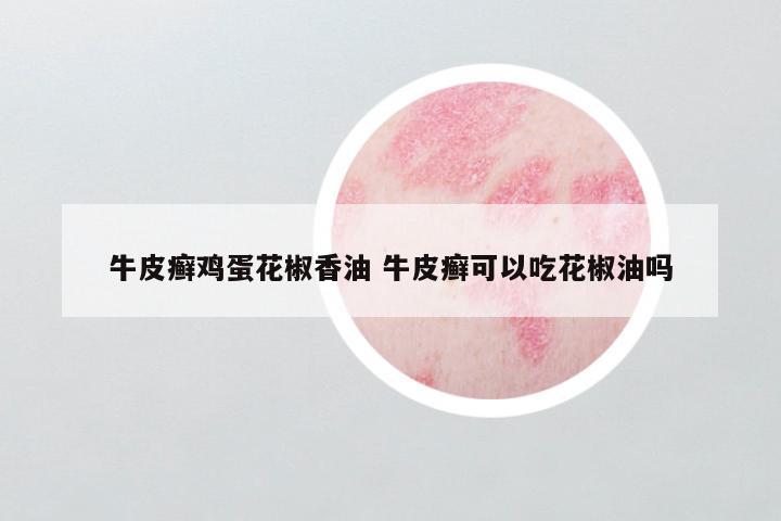牛皮癣鸡蛋花椒香油 牛皮癣可以吃花椒油吗