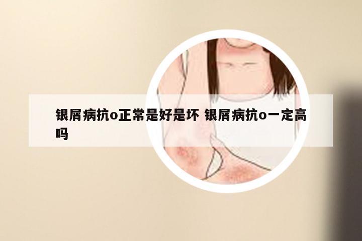 银屑病抗o正常是好是坏 银屑病抗o一定高吗