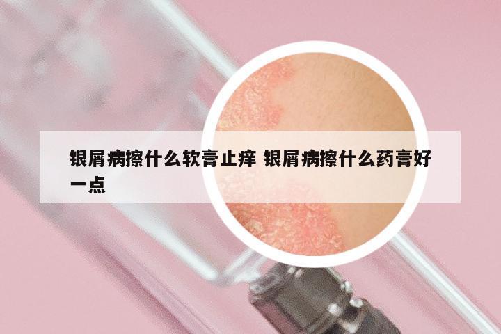 银屑病擦什么软膏止痒 银屑病擦什么药膏好一点