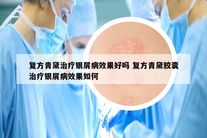 复方青黛治疗银屑病效果好吗 复方青黛胶囊治疗银屑病效果如何
