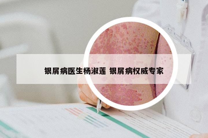 银屑病医生杨淑莲 银屑病权威专家