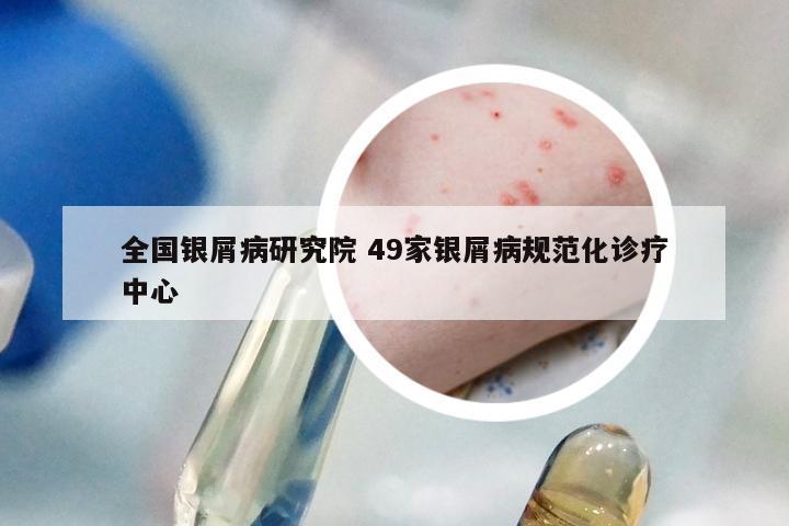 全国银屑病研究院 49家银屑病规范化诊疗中心