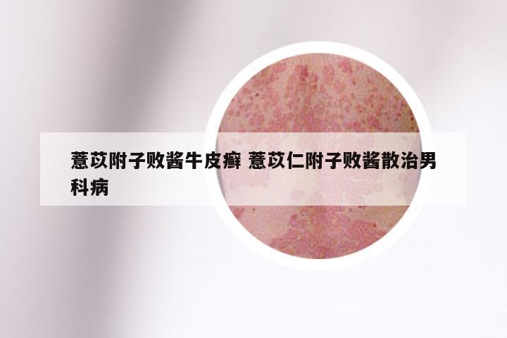 薏苡附子败酱牛皮癣 薏苡仁附子败酱散治男科病