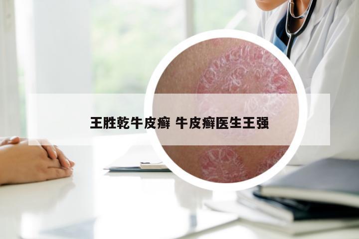 王胜乾牛皮癣 牛皮癣医生王强