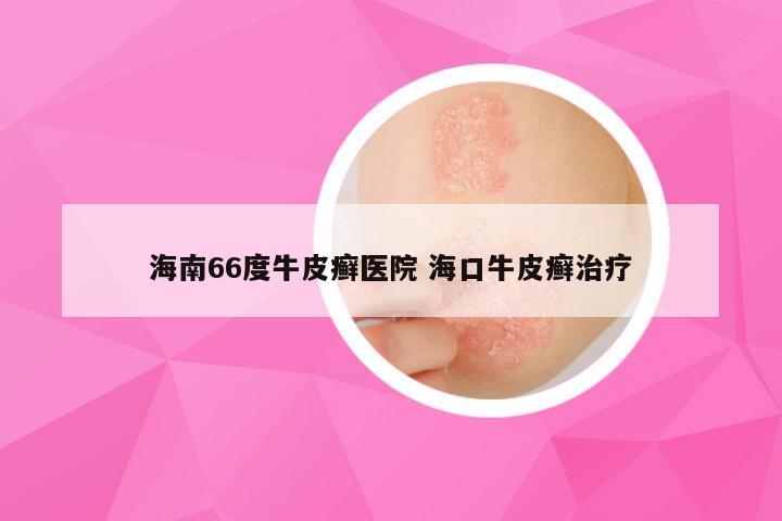 海南66度牛皮癣医院 海口牛皮癣治疗
