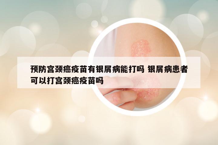 预防宫颈癌疫苗有银屑病能打吗 银屑病患者可以打宫颈癌疫苗吗