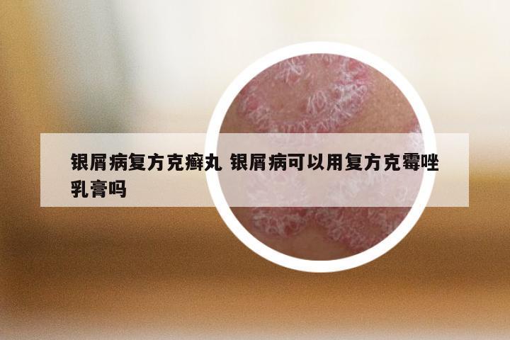 银屑病复方克癣丸 银屑病可以用复方克霉唑乳膏吗