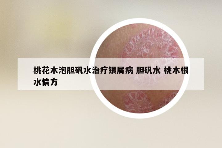 桃花木泡胆矾水治疗银屑病 胆矾水 桃木根水偏方