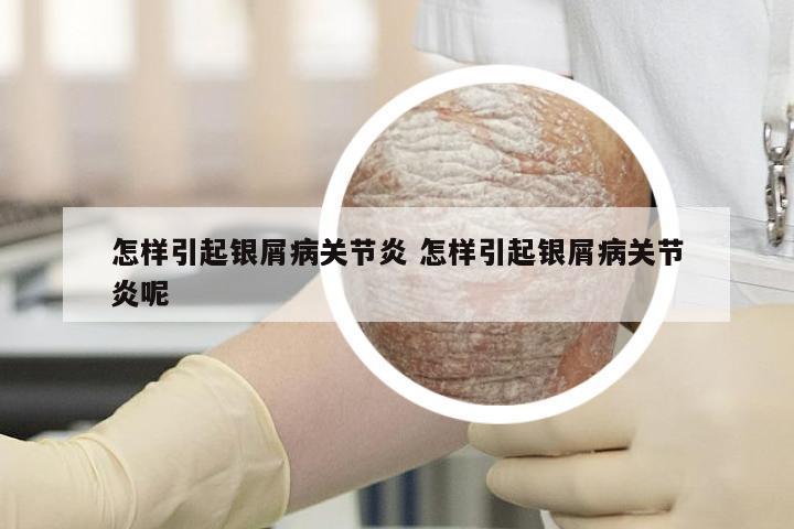 怎样引起银屑病关节炎 怎样引起银屑病关节炎呢