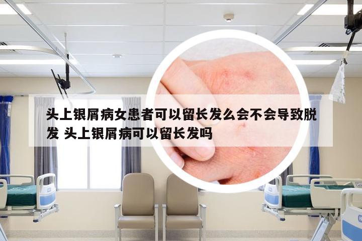 头上银屑病女患者可以留长发么会不会导致脱发 头上银屑病可以留长发吗