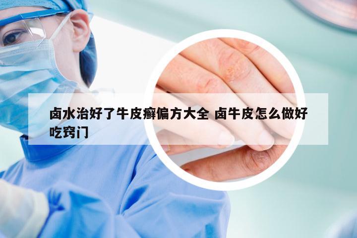 卤水治好了牛皮癣偏方大全 卤牛皮怎么做好吃窍门