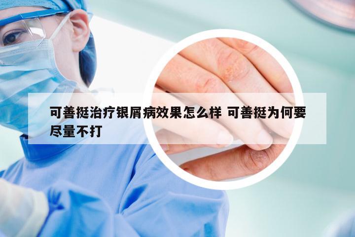 可善挺治疗银屑病效果怎么样 可善挺为何要尽量不打