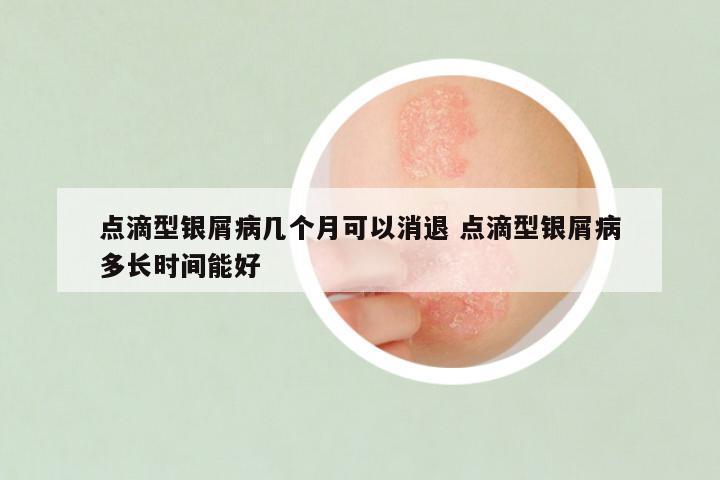 点滴型银屑病几个月可以消退 点滴型银屑病多长时间能好