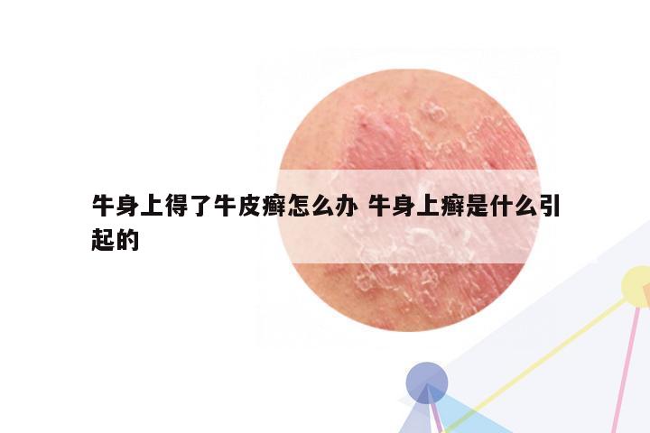 牛身上得了牛皮癣怎么办 牛身上癣是什么引起的