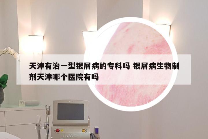 天津有治一型银屑病的专科吗 银屑病生物制剂天津哪个医院有吗