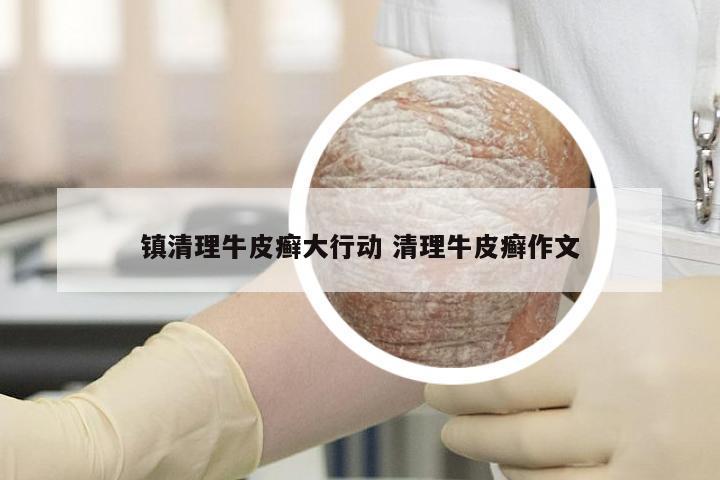镇清理牛皮癣大行动 清理牛皮癣作文
