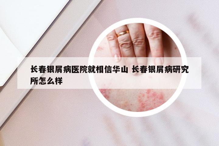 长春银屑病医院就相信华山 长春银屑病研究所怎么样