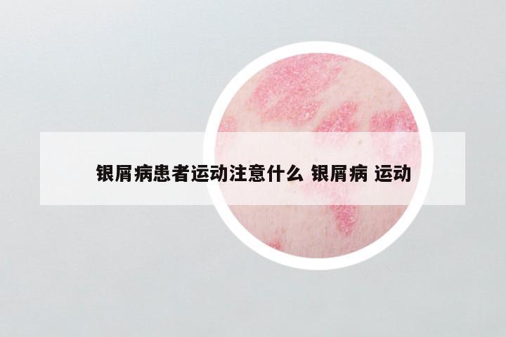 银屑病患者运动注意什么 银屑病 运动