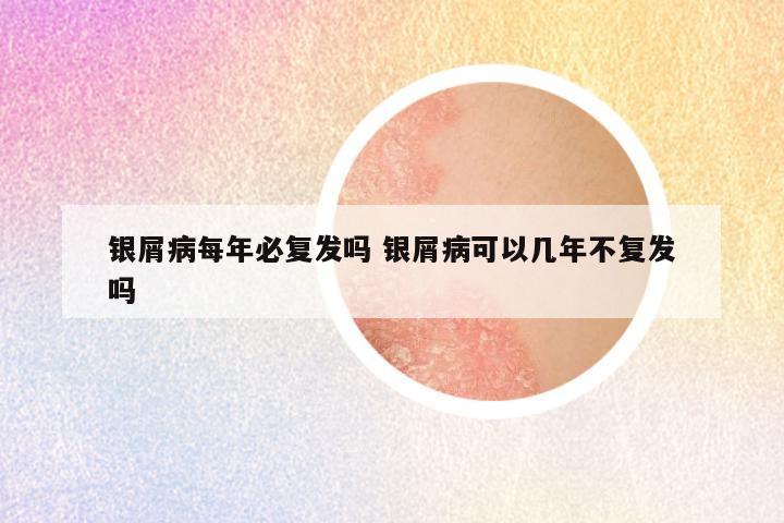 银屑病每年必复发吗 银屑病可以几年不复发吗